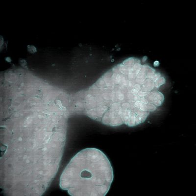 Application Note: Super-Resolution ExM with&nbsp;AION